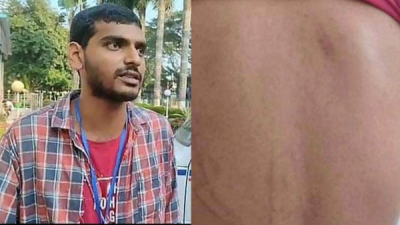 নজরুল বিশ্ববিদ্যালয়ের শিক্ষার্থীকে মারধর করেছে মমেক হাসপাতালে আনসাররা