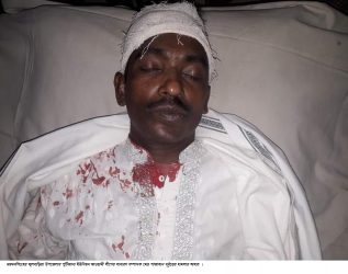 ফুলবাড়ীয়ায় ইউনিয়ন আ’লীগের সেক্রেটারি দুবৃত্তের হামলায় আহত