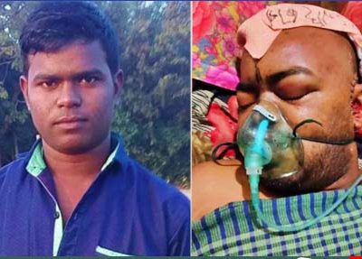 নান্দাইলে প্রতিবেশীদের কুপে আরশাদুলের মাথায় ৪৪টা সেলাইঃ মগজ সাভারে
