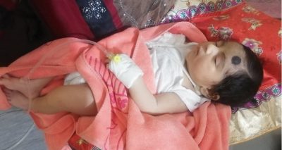 নিহত মায়ের পেট ফেটে অলৌকিকভাবে জন্ম নেওয়া সেই শিশুটি জন্ডিসে আক্রান্ত