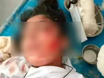 গফরগাঁওয়ে পরীক্ষা দিতে এসে বখাটের  খুরের  আঘাতে কলেজছাত্রী আহত