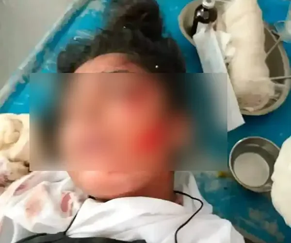 গফরগাঁওয়ে পরীক্ষা দিতে এসে বখাটের  খুরের  আঘাতে কলেজছাত্রী আহত