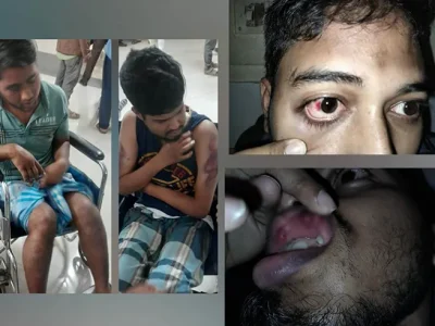 শিবির সন্দেহে চট্টগ্রাম মেডিকেল কলেজের ৪ শিক্ষার্থীকে রাতভর অমানবিক নির্যাতন