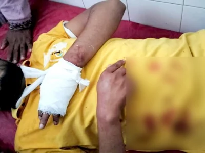 গৌরীপুর উপজেলায় ছাত্রলীগ নেতার হাতের রগ কেটে দিয়েছে সন্ত্রাসী