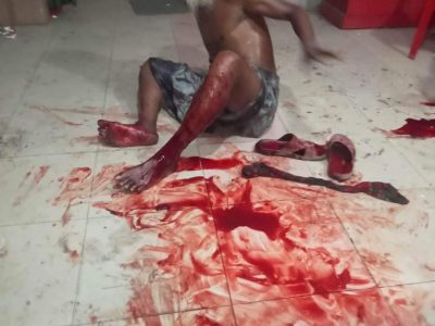 তারাকান্দায় নির্বাচনকে কেন্দ্র করে আওয়ামী লীগের দলীয় ও ‘বিদ্রোহী’ প্রার্থীর সমর্থকদের মধ্যে ব্যাপক সংঘর্ষঃ আহত ১৫