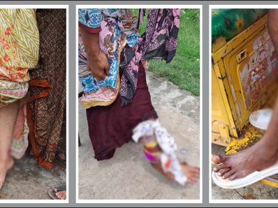 ময়মনসিংহে এক পাগলা কুকুরের কামড়ে নারী-শিশুসহ অন্তত আহত ৪০