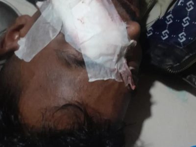 গফরগাঁওয়ে মধ্যরাতে চাঁদার জন্য অটোচালককে কুপিয়ে জখম