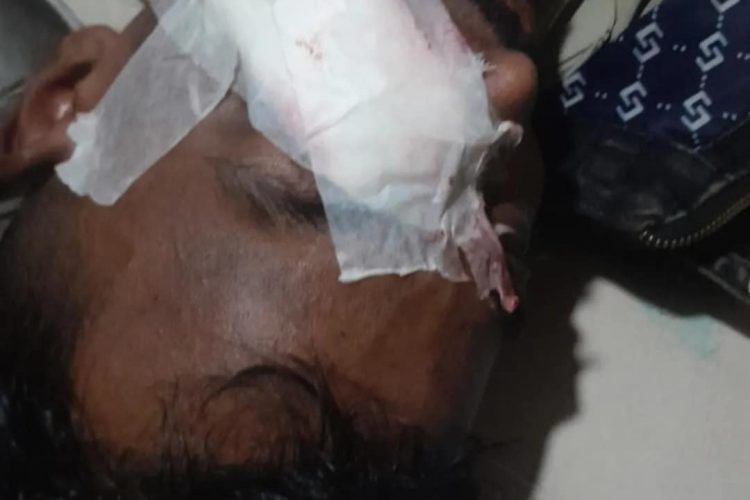 গফরগাঁওয়ে মধ্যরাতে চাঁদার জন্য অটোচালককে কুপিয়ে জখম