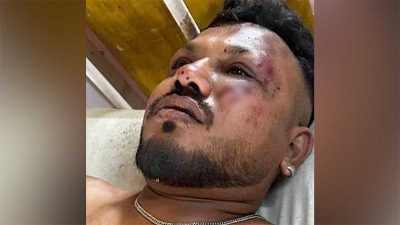 ভারতে বিমান দুর্ঘটনায় অলৌকিকভাবে বেঁচে যাওয়া যাত্রীর দুর্ঘটনার  বর্ণনা