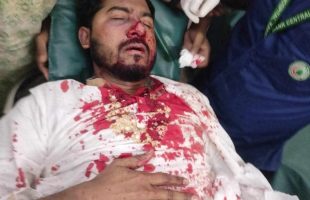 জাপা কার্যালয়ের সামনে সংঘর্ষের সময় পুলিশের লাঠিচার্জঃ গণঅধিকারের সভাপতি নুর রক্তাক্ত