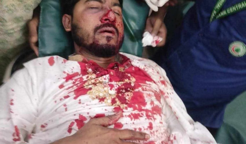 জাপা কার্যালয়ের সামনে সংঘর্ষের সময় পুলিশের লাঠিচার্জঃ গণঅধিকারের সভাপতি নুর রক্তাক্ত