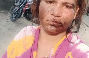 অপহরণ মামলা করায় নারী নৃত্য শিল্পীকে চুল কেটে, মুখে কালি মেখে নির্যাতন