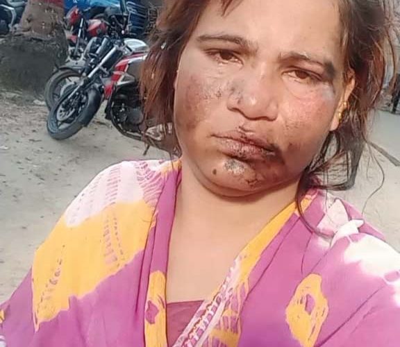 অপহরণ মামলা করায় নারী নৃত্য শিল্পীকে চুল কেটে, মুখে কালি মেখে নির্যাতন