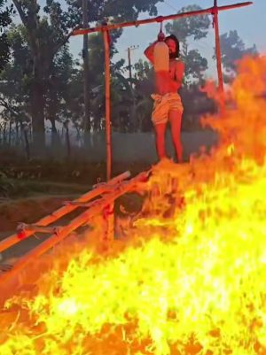 আগুন নিয়ে কন্টেন্ট তৈরী করতে গিয়ে অগ্নিদগ্ধ, পুড়ে গেছে ৪০ শতাংশ