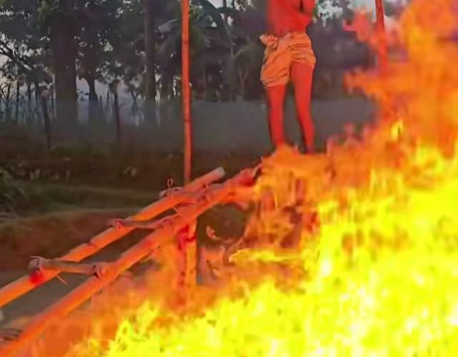 আগুন নিয়ে কন্টেন্ট তৈরী করতে গিয়ে অগ্নিদগ্ধ, পুড়ে গেছে ৪০ শতাংশ