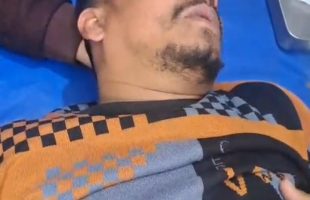 ময়মনসিংহে স্বতন্ত্র প্রার্থীর পক্ষে মিষ্টি বিতরণ করায় যুবদল নেতাকে হাতুড়ি পেটা